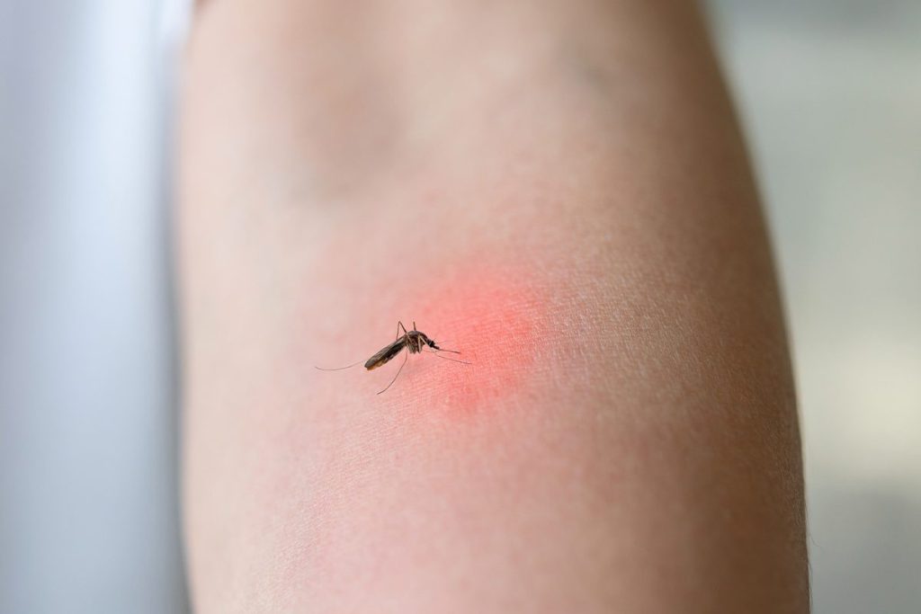 PREOCUPACIÓN POR LAS PICADURAS DE MOSQUITOS