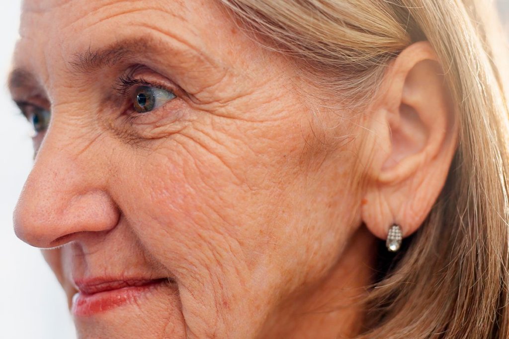 UN ESTUDIO DESCUBRE AL CULPABLE DE LAS ARRUGAS