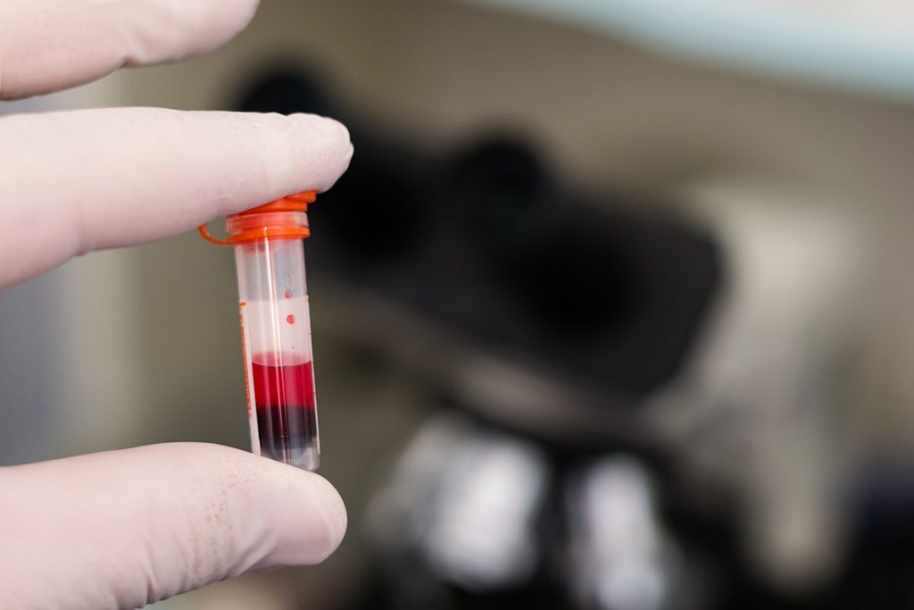 UNA GRAN INVERSIÓN EN LA CREACIÓN DE LA SANGRE ARTIFICIAL EN POLVO