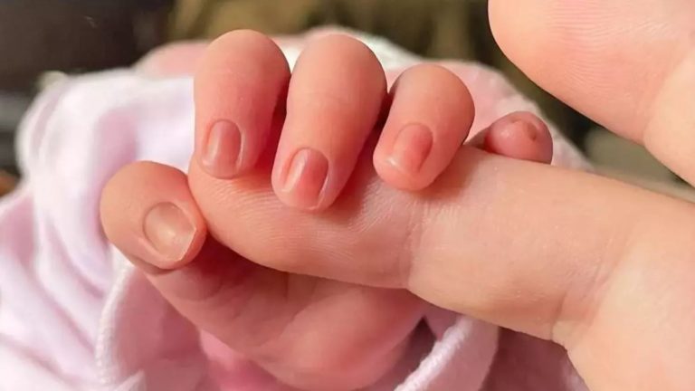 Bebés, mayores, animales y personas con movilidad reducida, las víctimas silenciosas del calor del verano