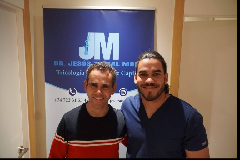 Preparar el trasplante capilar con Clínica Capilar Mora en Madrid; técnica FUE Zafiro HD y financiación sin intereses