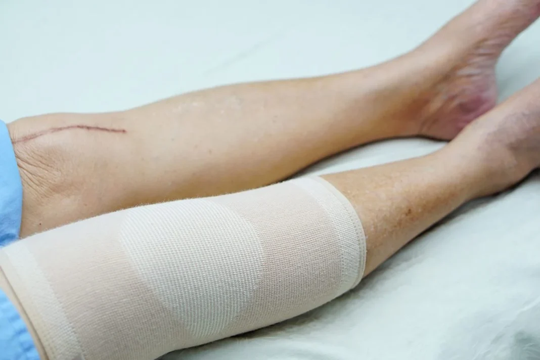 EL FUTURO DE LA RECUPERACIÓN DE HUESOS