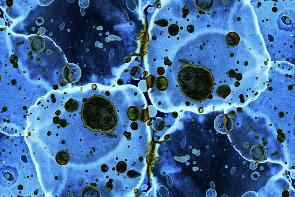 ESTA BACTERIA TAMPOCO SE DETIENE CON EL FRÍO EXTREMO