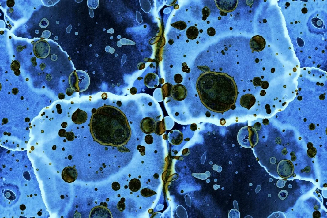 ESTA BACTERIA TAMPOCO SE DETIENE CON EL FRÍO EXTREMO