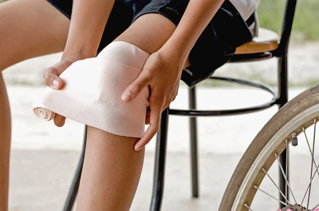 FRACTURAS IRREGULARES EN LOS HUESOS