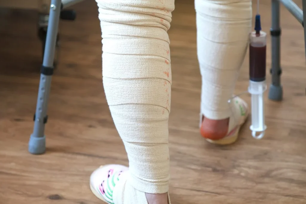 UN AVANCE CON UN GRAN IMPACTO PARA TRATAR PROBLEMAS DE HUESOS