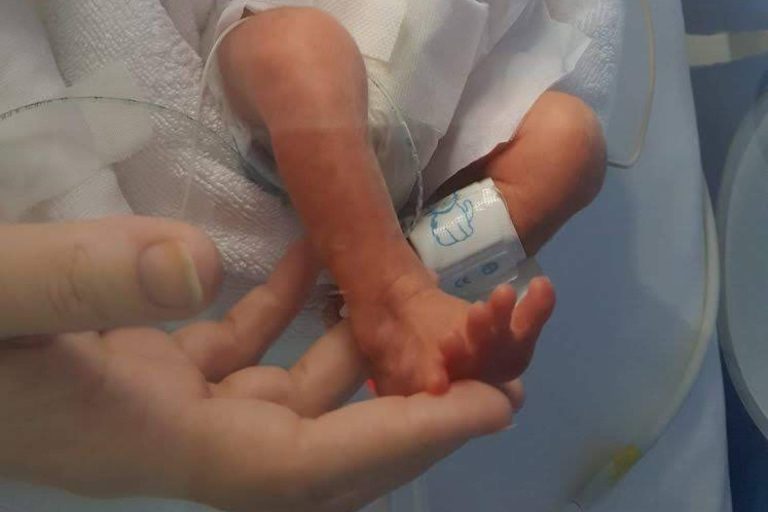Ayudas públicas por prematuridad, acompañamiento y orientación para familias desde el nacimiento