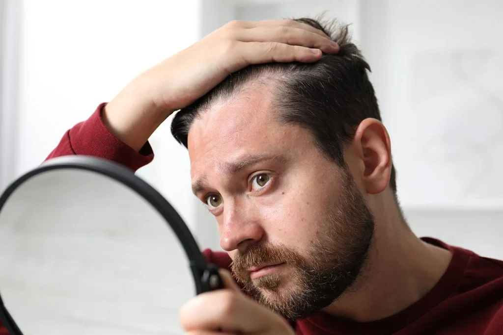 La lucha contra la calvicie podría resolverse con un edulcorante natural 100% seguro y autorizado 4 Expertos en salud señalan un edulcorante natural autorizado como posible solución para la calvicie