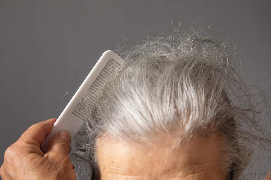 Japón investiga las canas y encuentra motivos científicos para celebrar su aparición 3 Investigadores japoneses hallan beneficios inesperados en la aparición de canas según estudios científicos