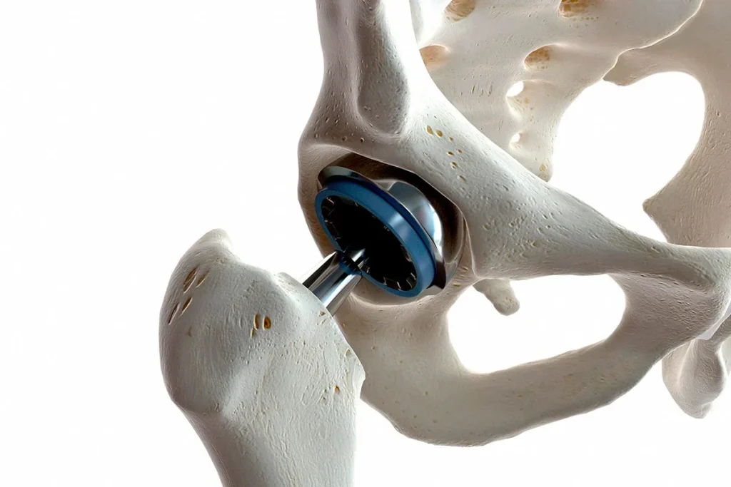 La tecnología médica se transforma con implantes que previenen infecciones tras las operaciones quirúrgicas 3 Un medicamento innovador abre nuevas posibilidades para frenar el envejecimiento celular