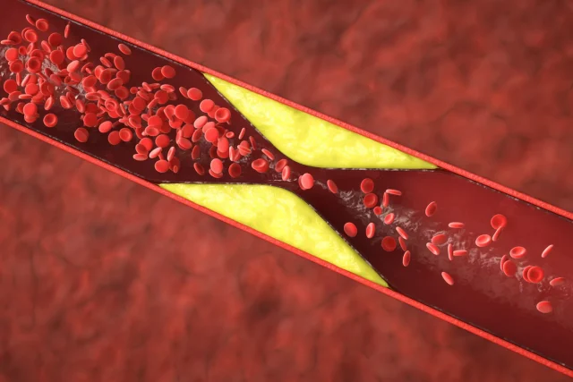 Tu cuerpo te avisa 6 meses antes de que el colesterol colapse tus arterias: la señal en tus pies que todos pasan por alto