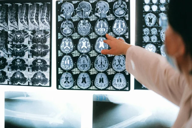 Las Olimpiadas del daño cerebral advierten sobre los 100.000 casos de ictus al año: "No se trata solo de sobrevivir"