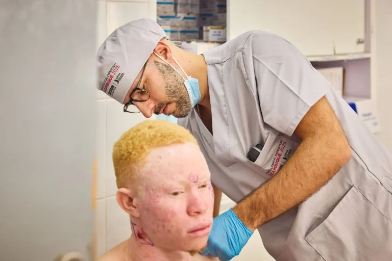 ISDIN y África Directo superan las 5.200 personas con albinismo atendidas en Mozambique contra el cáncer de piel