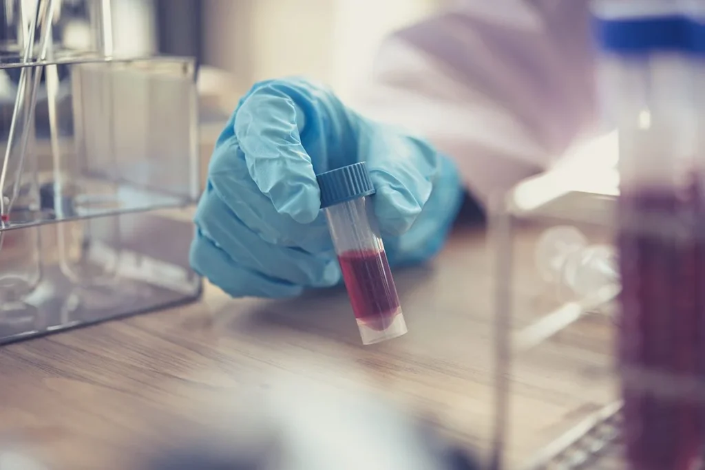 La sangre dorada, la joya médica que los científicos intentan replicar en laboratorio 4 Científicos desarrollan técnicas para reproducir la sangre dorada, considerada oro líquido en medicina