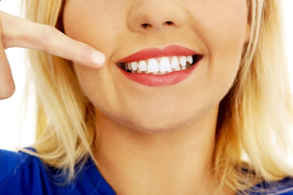 Investigaciones odontológicas apuntan a dientes blancos permanentes con métodos novedosos