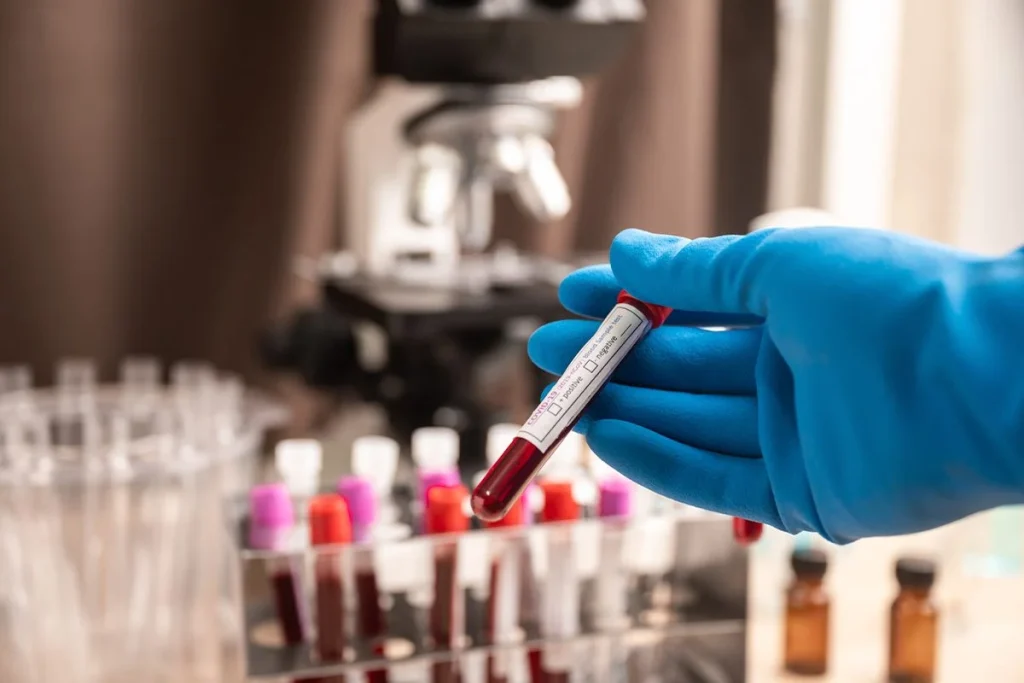 La sangre dorada, la joya médica que los científicos intentan replicar en laboratorio 3 Investigadores intentan sintetizar la sangre dorada, un recurso médico de alto valor terapéutico