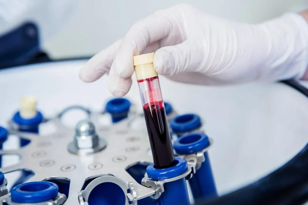 La sangre dorada, la joya médica que los científicos intentan replicar en laboratorio 2 La sangre dorada emerge como joya médica y científicos buscan replicarla en laboratorio