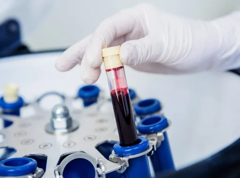 La sangre dorada emerge como joya médica y científicos buscan replicarla en laboratorio La sangre dorada emerge como joya médica y científicos buscan replicarla en laboratorio