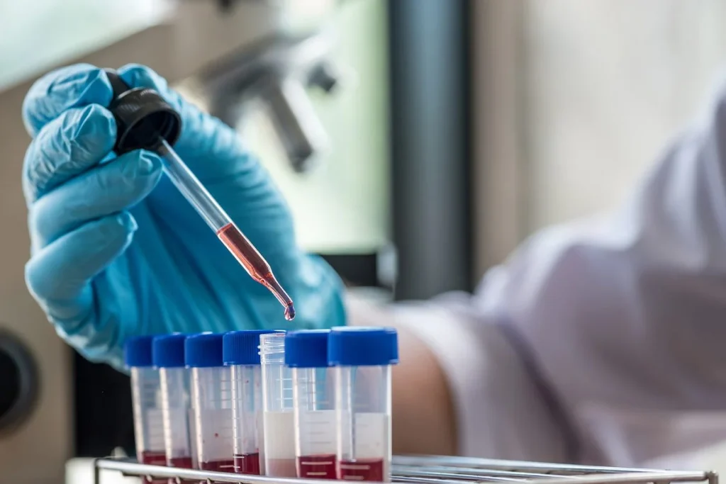 La sangre dorada, la joya médica que los científicos intentan replicar en laboratorio 1 La sangre dorada se convierte en objetivo de la ciencia para crear versiones artificiales en el laboratorio