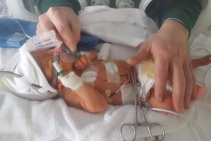 Día Mundial de la Prematuridad; detrás de cada bebé hay una familia que no se rinde