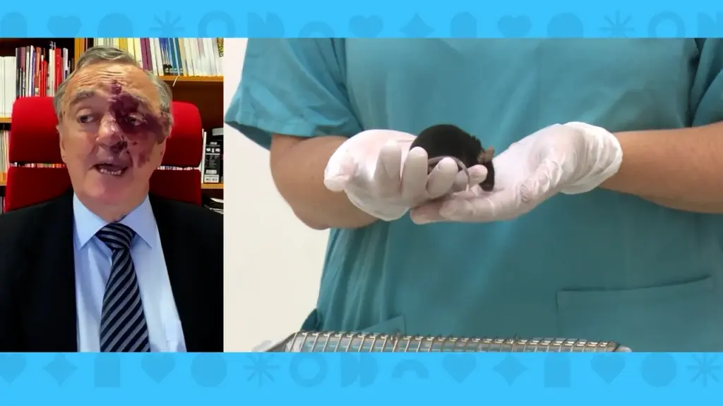 “Atacamos por dos vías y fue la primera vez que un tumor regresaba”