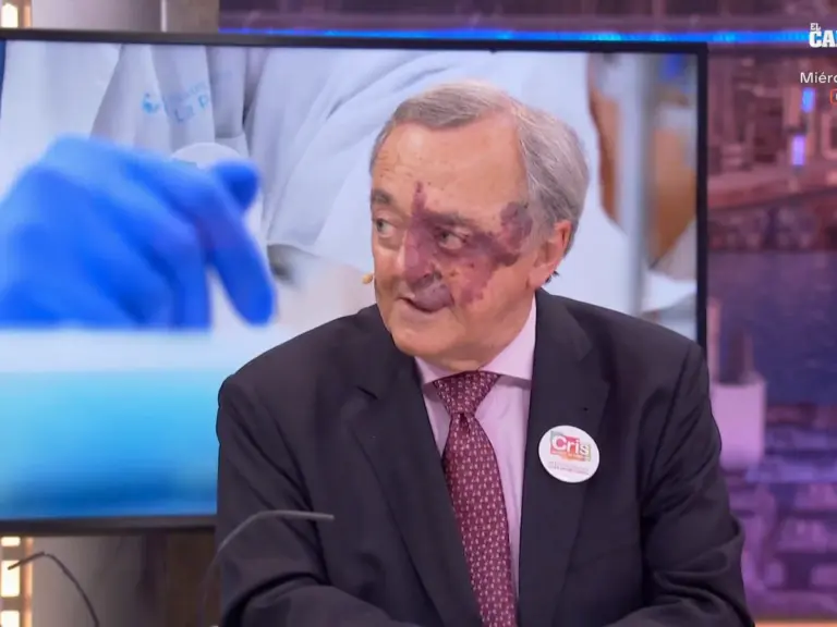 “Los tumores no vuelven”: El doctor Mariano Barbacid explica en 'El Hormiguero' su avance histórico contra el cáncer de páncreas