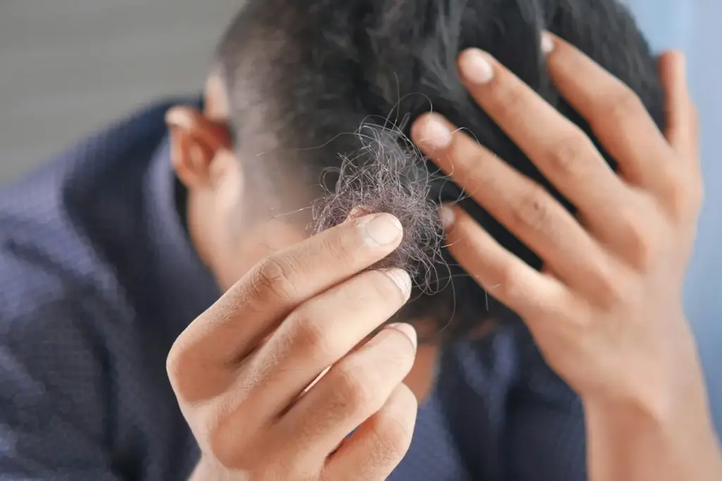 Adiós a la calvicie: un nuevo fármaco basado en medicina tradicional china logra regenerar el cabello en los primeros estudios