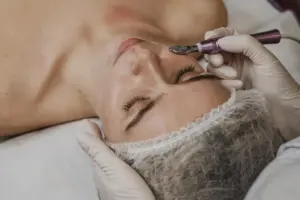 Dermaplaning