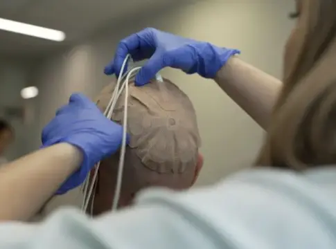 ensayo campos eléctricos inmunoterapia frente al glioblastoma.