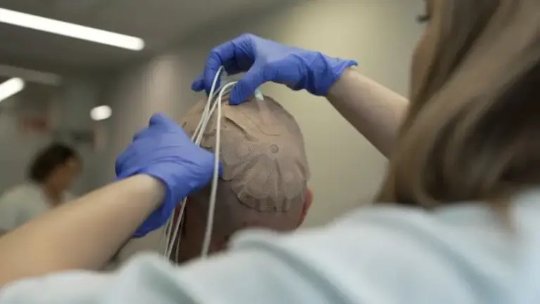 El Hospital público 12 de Octubre participa en un ensayo en Fase 3 que combina campos eléctricos e inmunoterapia frente al glioblastoma