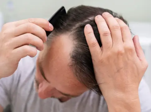 caida de cabello freepik 00