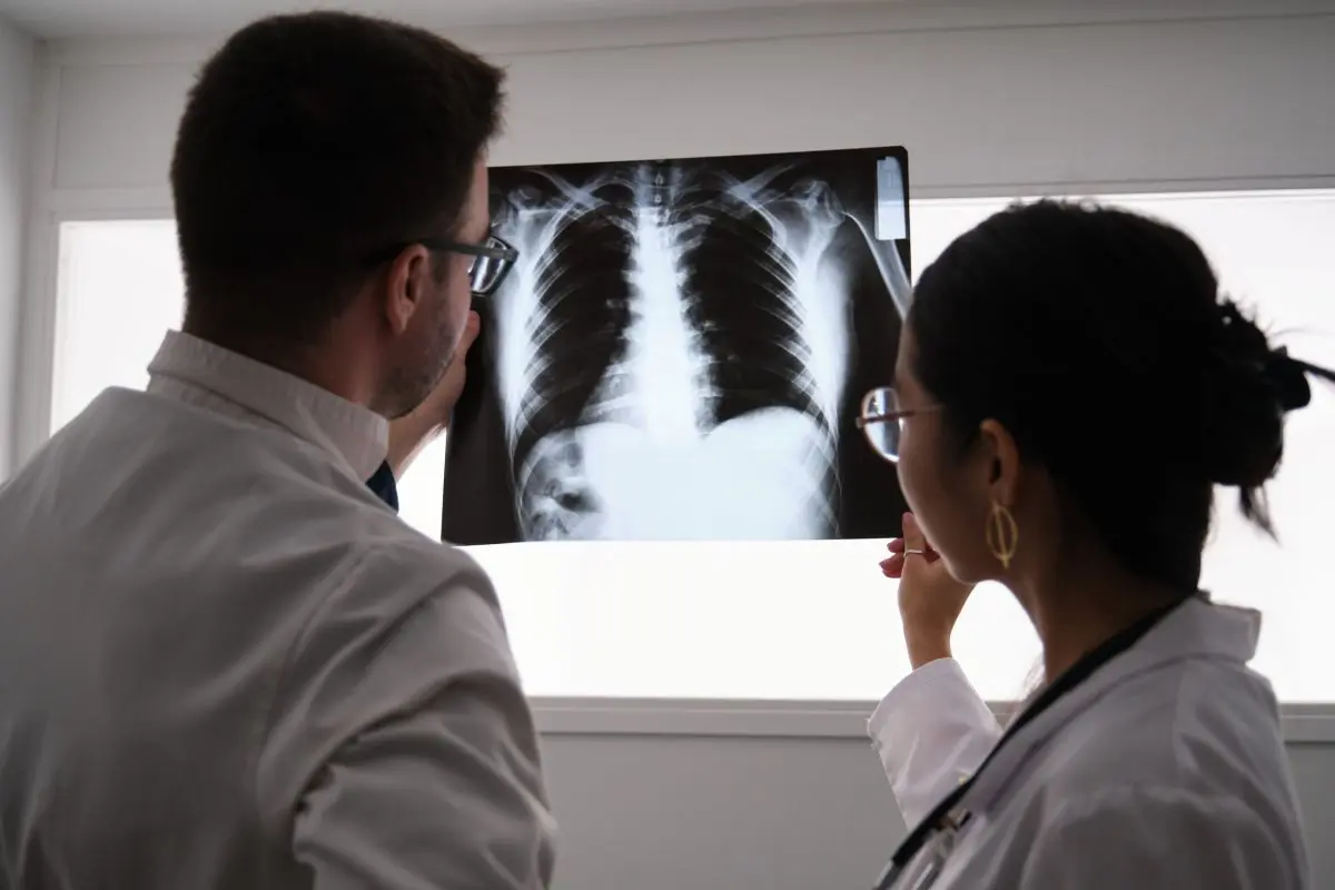 fibrosis pulmonar Dos médicos estudian una imagen de rayos X